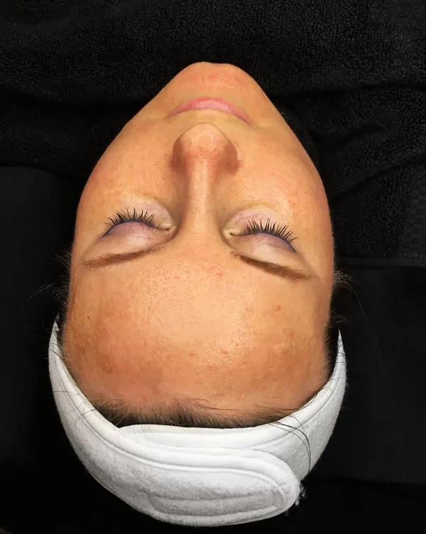 After relaxing deluxe facial!